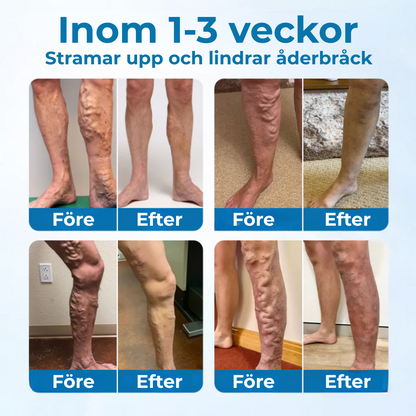 VitaVein™ | Naturlig lindring för trötta, tunga och svullna ben.