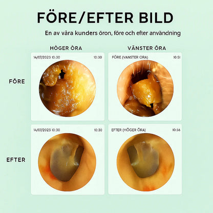 SafeHear Smart | Klara öron, bättre hörsel – SafeHear Smart för säker och exakt rengöring!