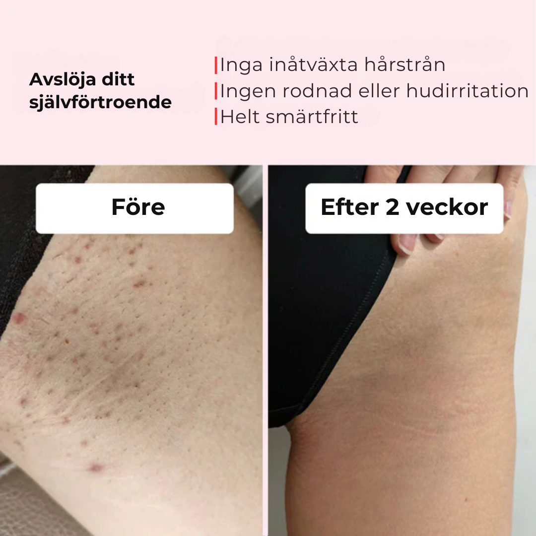 Smoothly™ | Slät hud som varar