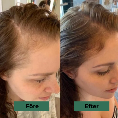 VitaRay™ | Få tillbaka ditt tjocka, levande hår – utan smärta eller mediciner!