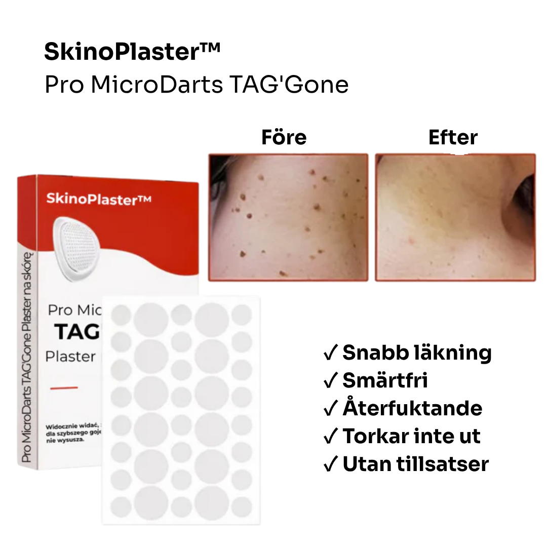 SkinoPlaster™ Pro MicroDarts TAG'Gone | Ta bort hängande födelsemärken smärtfritt – utan ärr, utan snitt, utan stress!