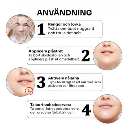 SkinoPlaster™ Pro MicroDarts TAG'Gone | Ta bort hängande födelsemärken smärtfritt – utan ärr, utan snitt, utan stress!