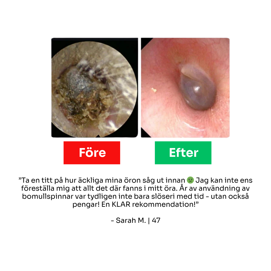 Aurisense™ PRO | Få de renaste öronen i ditt liv - på bara 60 sekunder