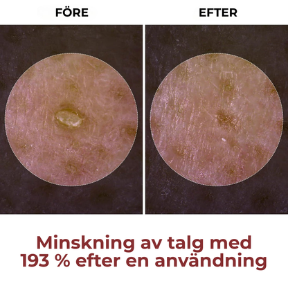 SkinRevive Duo | Strålande hud är bara två steg bort.