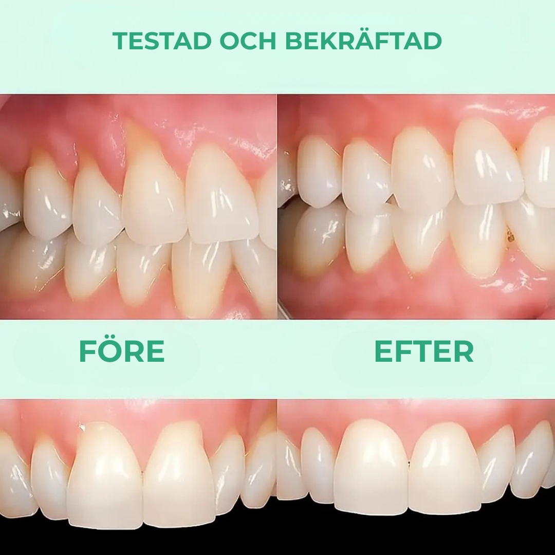GumCare™ | Friskare tandkött, fräschare andedräkt – synliga resultat på bara några veckor!