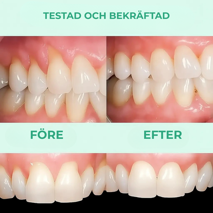 GumCare™ | Friskare tandkött, fräschare andedräkt – synliga resultat på bara några veckor!