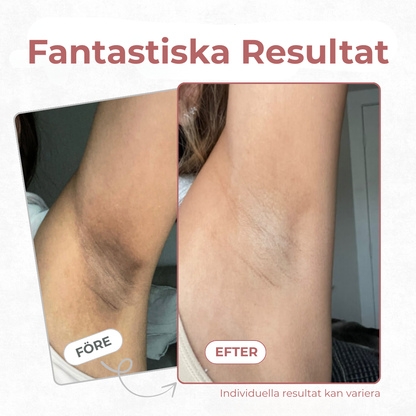 GlowPeel Body Shot™ | Kojic + Gurkmeja Kroppspeelingsspray