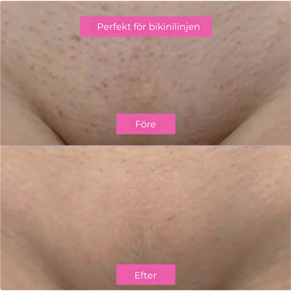 BareBloom™ | Len hud, långsammare hårväxt – din nya vardagsfavorit!