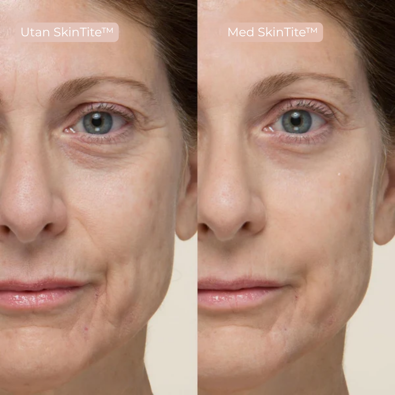 SkinTite™ | Omedelbar effekt mot svullnad och rynkor