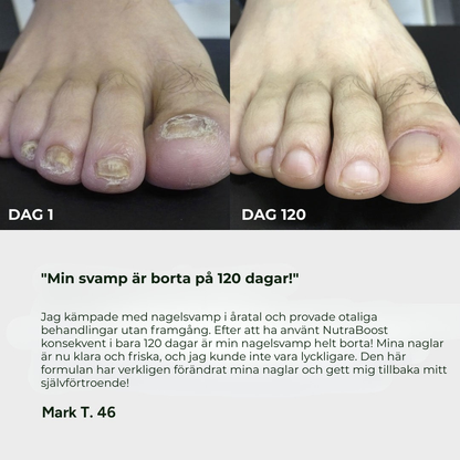 MycoClear™ | Nagelsvampsbehandlingsgel