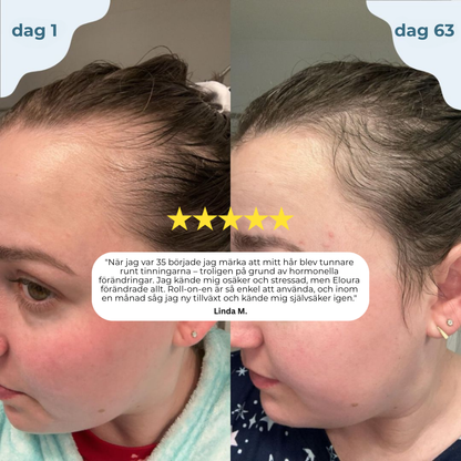 Follexa™ Hair Roll-On System | Återupptäck Ditt Hår – Fylligare, Starkare och Mer Livskraftigt!