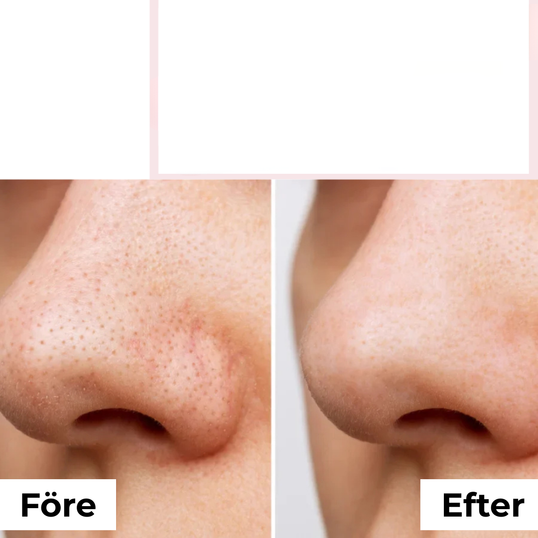 PurePulse™ | Djuprengöring & Pormaskborttagare