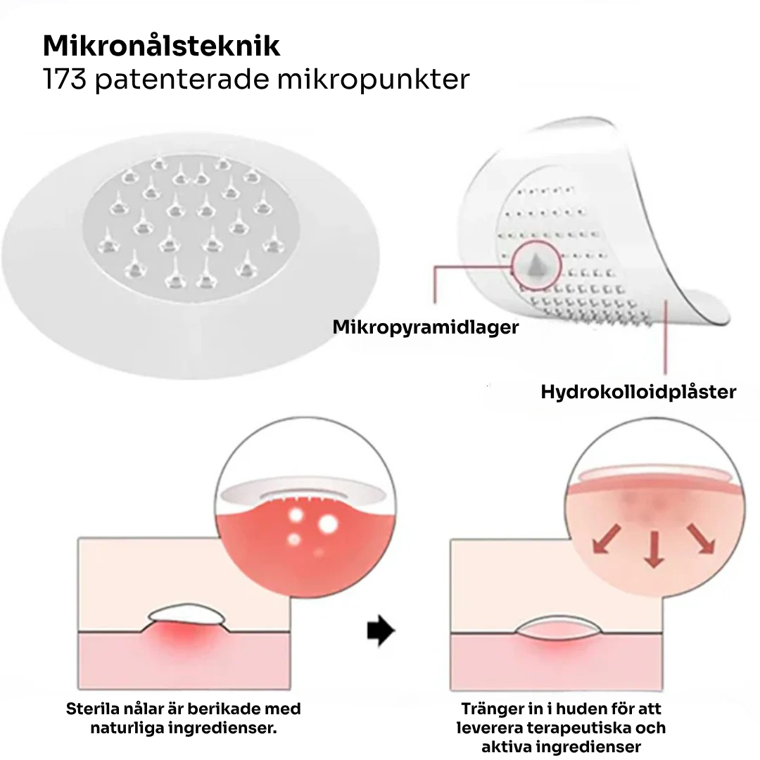 SkinoPlaster™ Pro MicroDarts TAG'Gone | Ta bort hängande födelsemärken smärtfritt – utan ärr, utan snitt, utan stress!