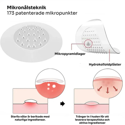 SkinoPlaster™ Pro MicroDarts TAG'Gone | Ta bort hängande födelsemärken smärtfritt – utan ärr, utan snitt, utan stress!
