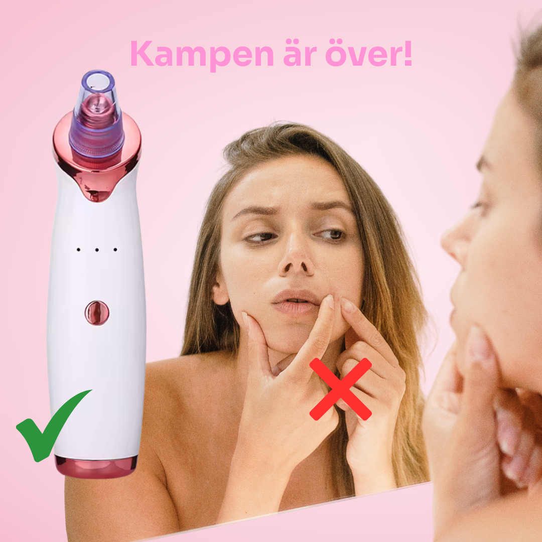SkinImpulse™ | Trött på envisa pormaskar? SkinImpulse™ rensar dina porer så att din hud äntligen kan andas.