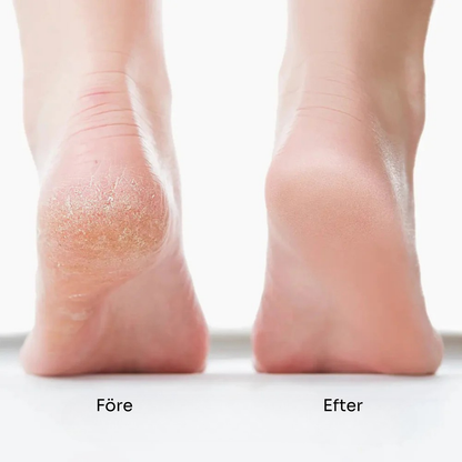 SilkStep™  | Förvandla dina fötter på några minuter med SilkStep™ – mjuka, släta resultat i salongkvalitet hemma!