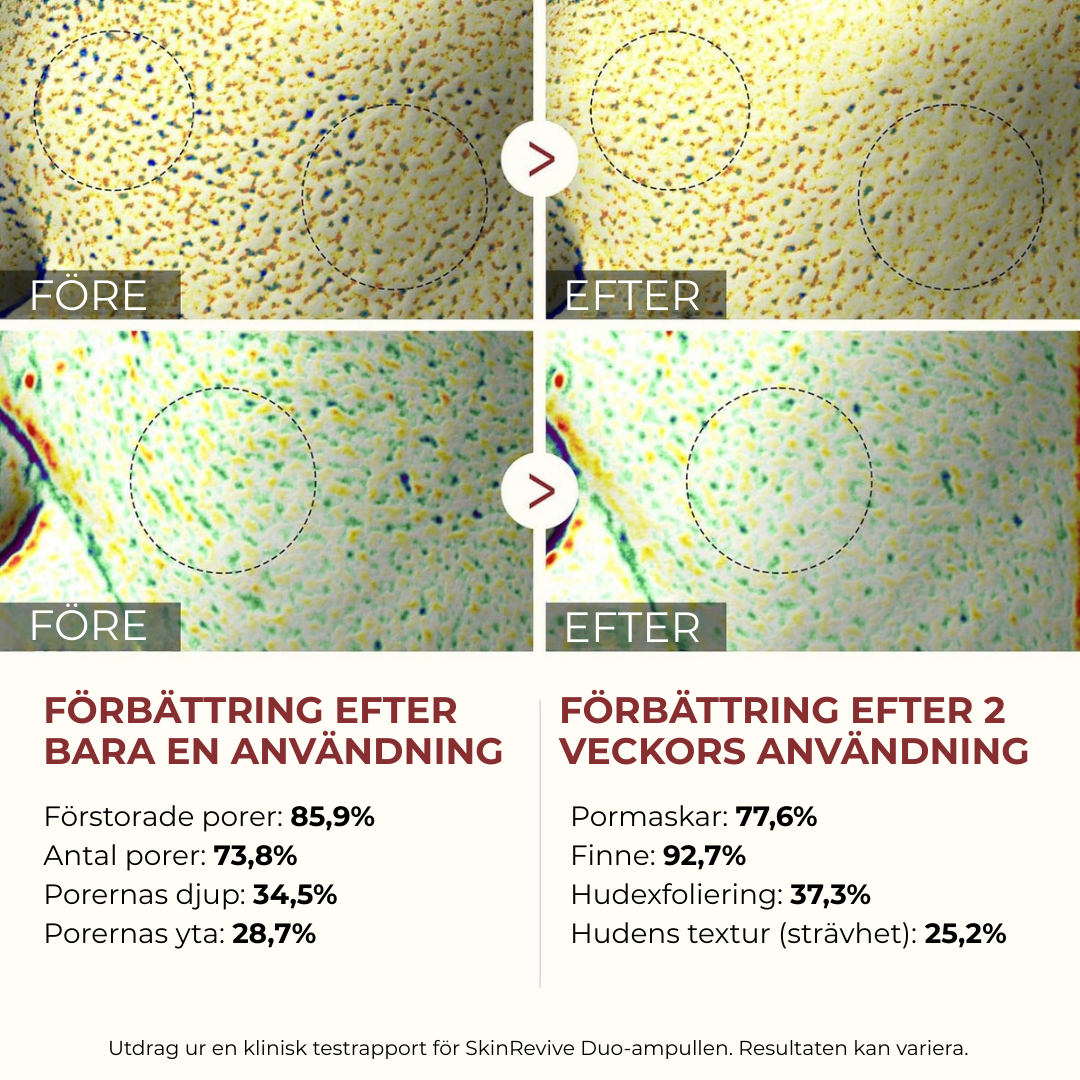 SkinRevive Duo | Strålande hud är bara två steg bort.