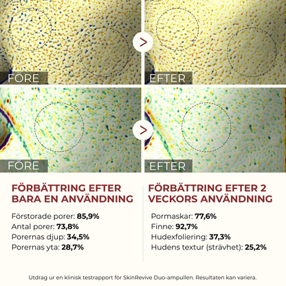SkinRevive Duo | Strålande hud är bara två steg bort.