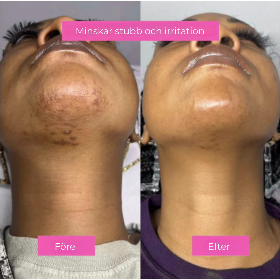BareBloom™ | Len hud, långsammare hårväxt – din nya vardagsfavorit!