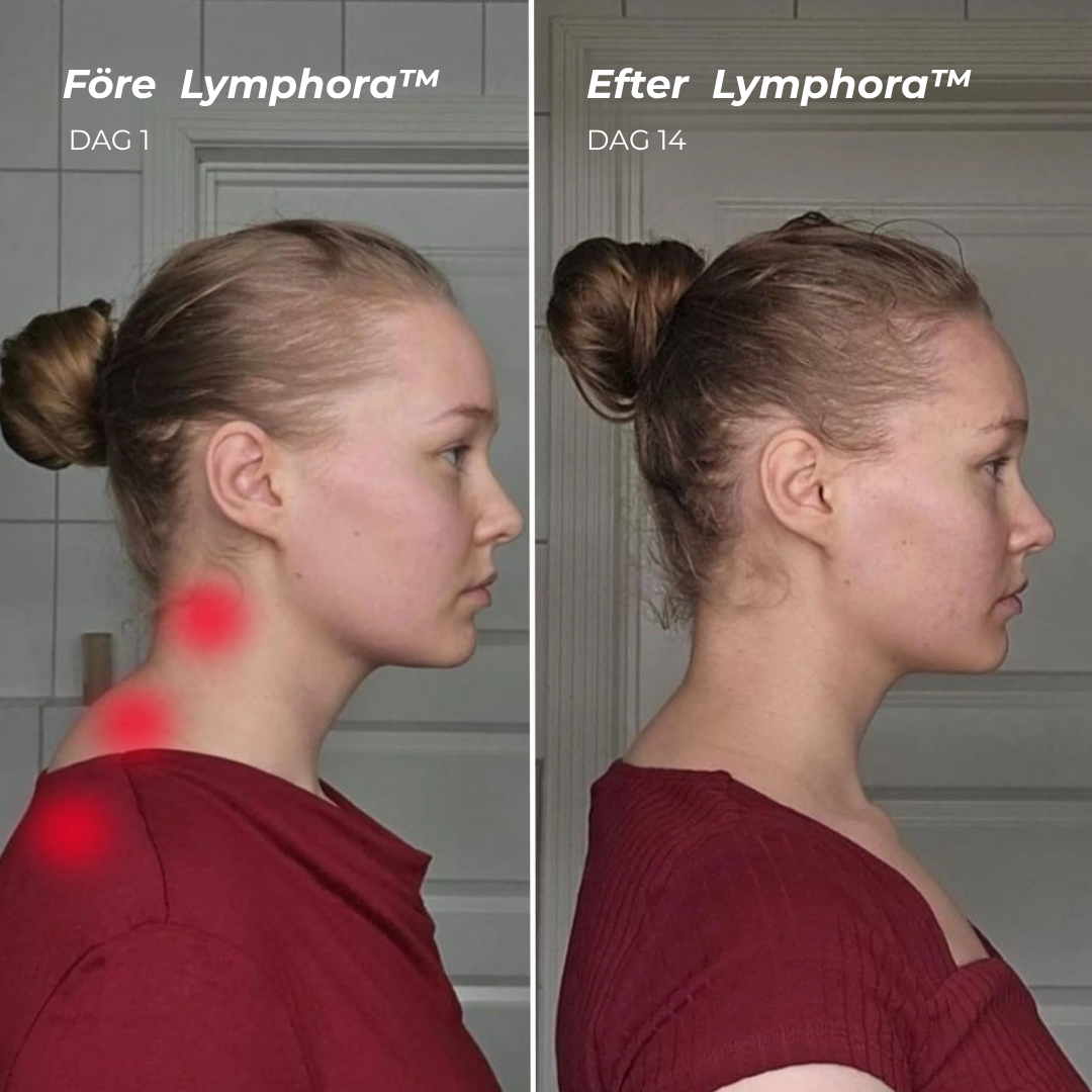 Lymphora™ Massager | En Daglig Stund som Formar och Avlastar Ditt Ansikte