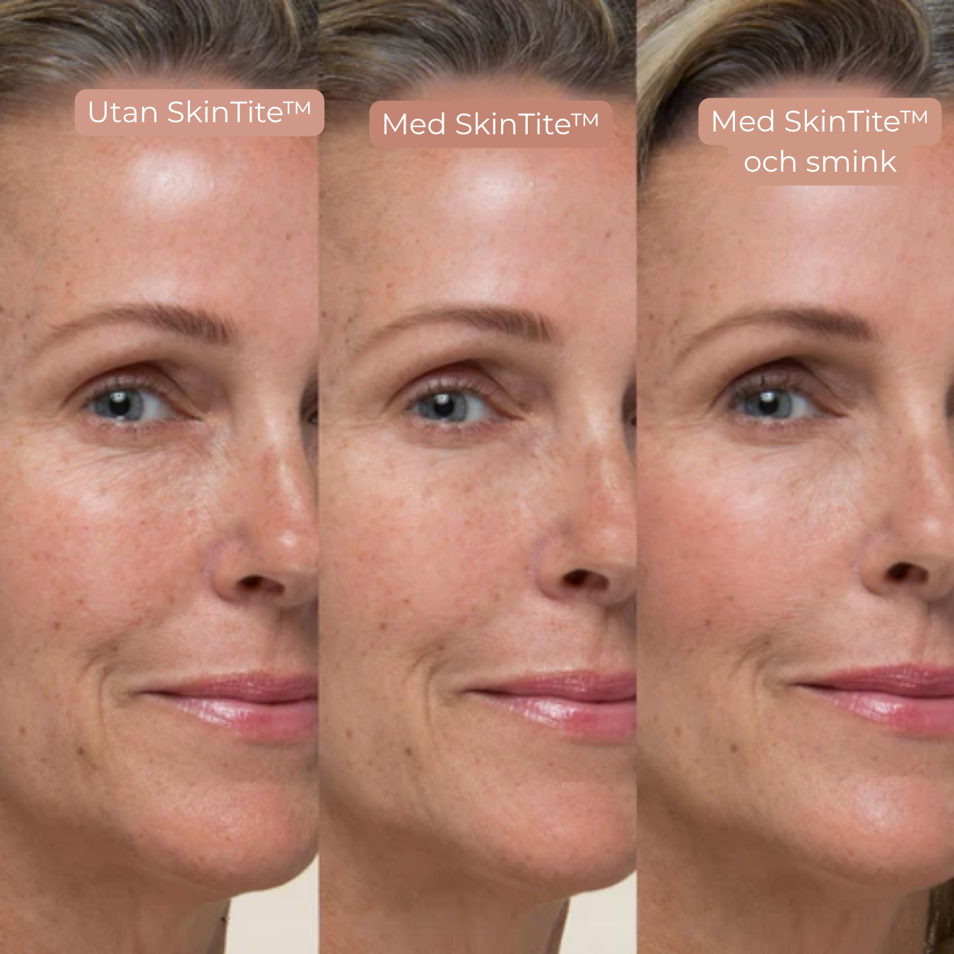 SkinTite™ | Omedelbar effekt mot svullnad och rynkor