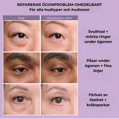 SkinTite™ | Omedelbar effekt mot svullnad och rynkor