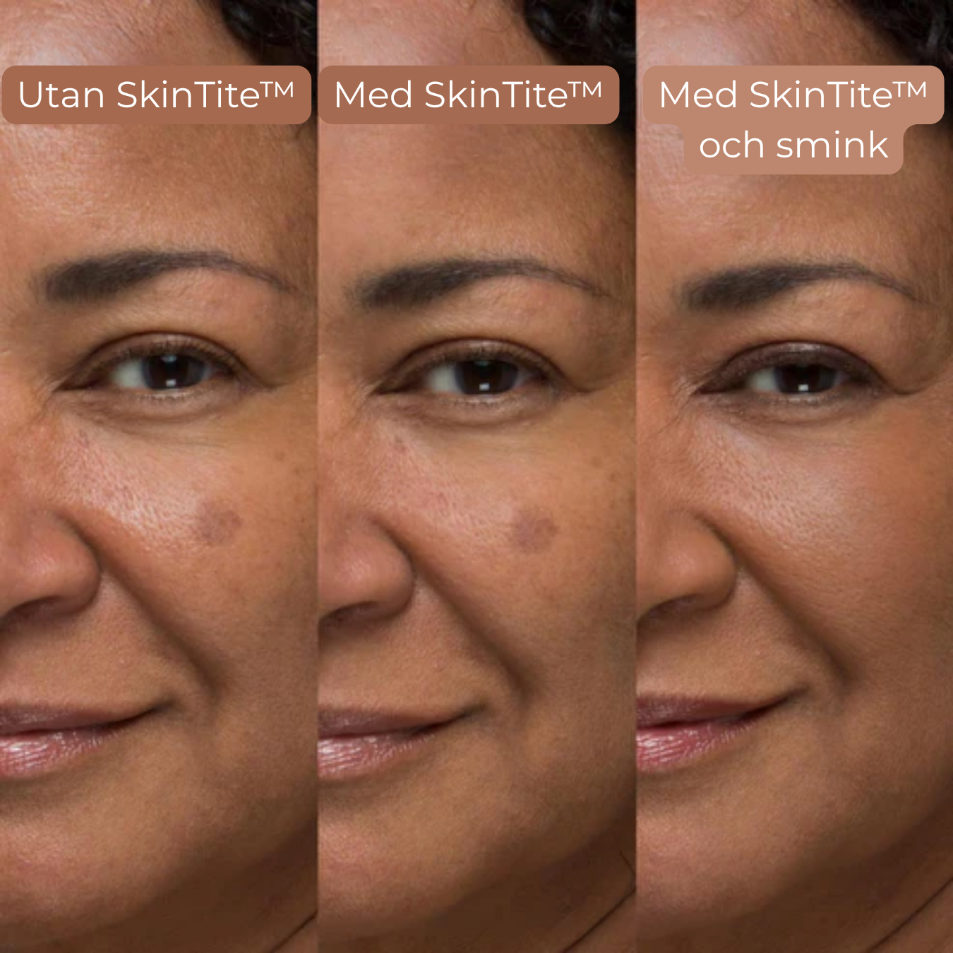 SkinTite™ | Omedelbar effekt mot svullnad och rynkor