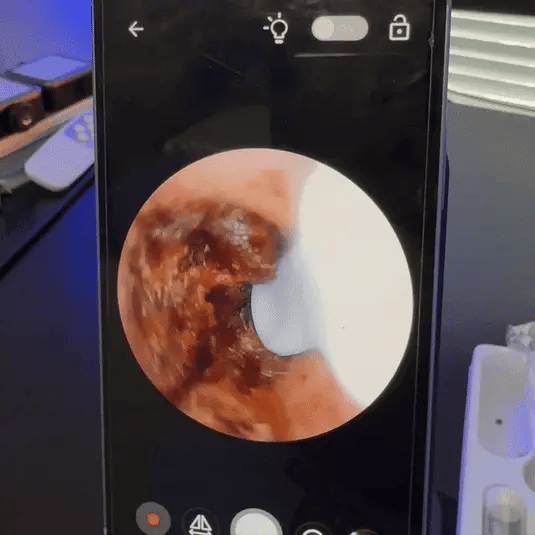 SafeHear Smart | Klara öron, bättre hörsel – SafeHear Smart för säker och exakt rengöring!