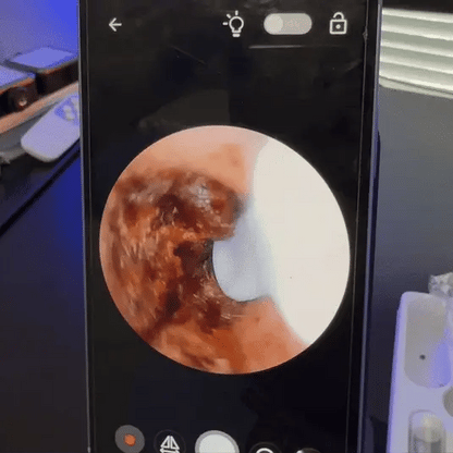 SafeHear Smart | Klara öron, bättre hörsel – SafeHear Smart för säker och exakt rengöring!