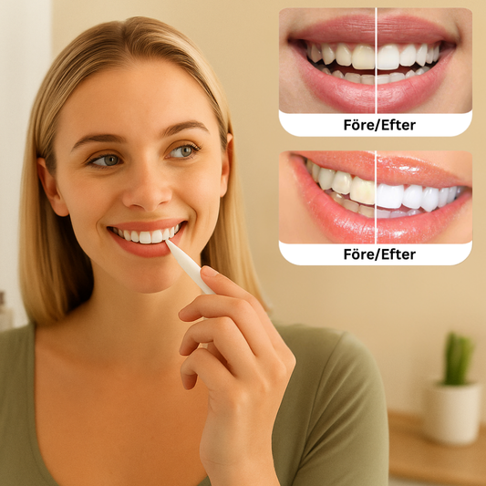 SmileBright™ tandblekningspenna | Professionell tandblekning hemma
