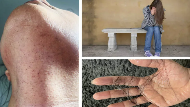 HairEase™ | Mjuk, hårfri hud utan stubb – direkt från roten