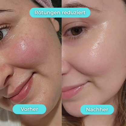 FrostyFace™ | Den virala Ice Glow för din morgonrutin