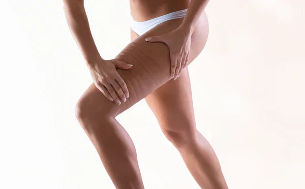 SilvaSculpt™ | Säg adjö till celluliter och hej till din bästa hud någonsin.